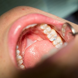 Patient receiving dental treatment