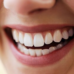 Closeup of healthy teeth and gums