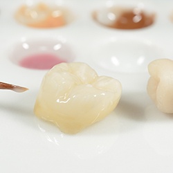 Tooth colored dental crowns