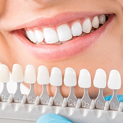 Smile compared to tooth shade chart